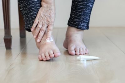 Personne diabétique appliquant de la crème de soin sur ses pieds.